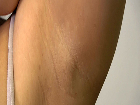 素人娘の全裸図鑑25　今時の女の子12名が恥らいながら脱衣していく様子をじっくり撮影した、変態紳士のためのヘアヌードコレクション　サンプル画像06